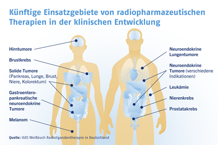 IGES_Grafik_Krankheiten_2025_lo.png