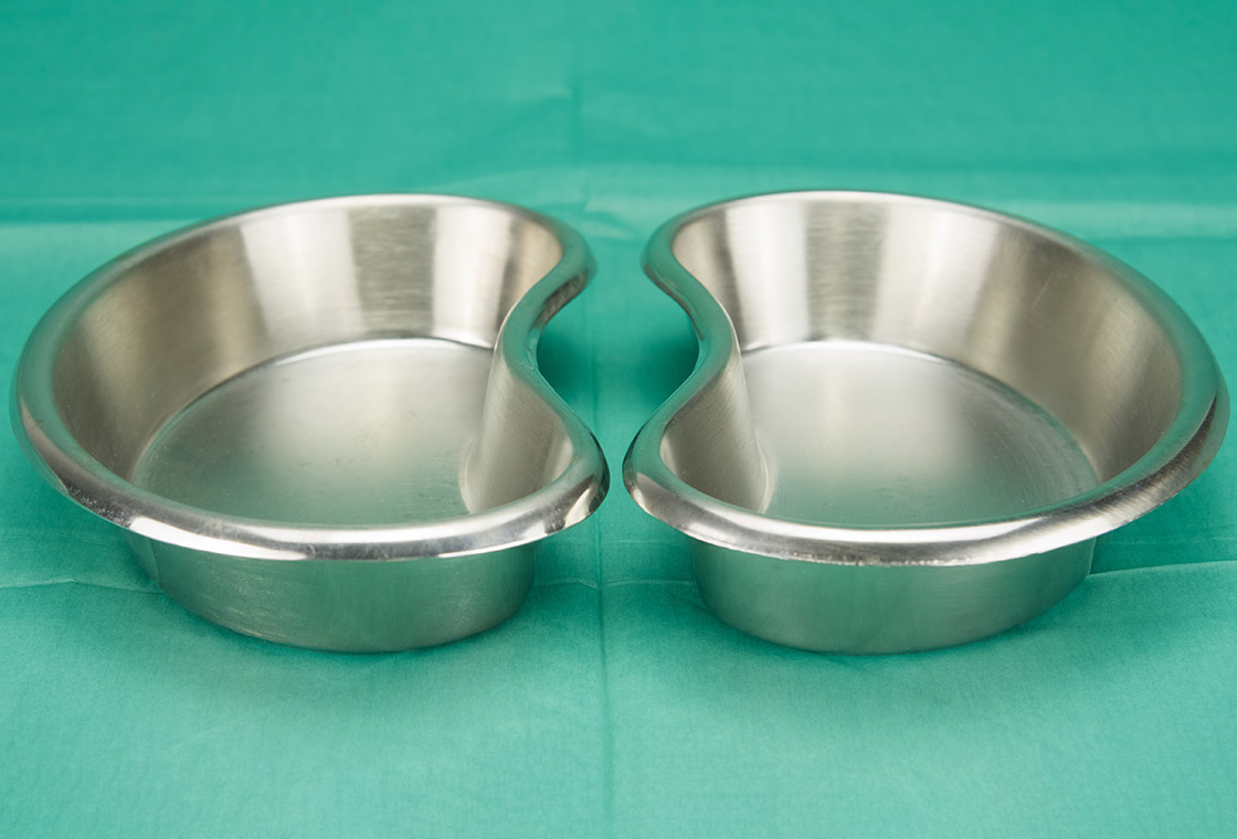 Diagnose chronischer Nierenerkrankung: Risikobasiertes Screening könnte Tausende Fälle früher entdecken